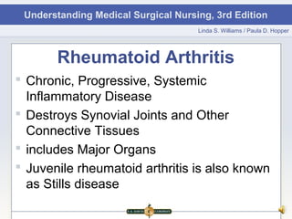 Understanding Medical Surgical Nursing, 3rd Edition
                                     Linda S. Williams / Paula D. Hopper




       Rheumatoid Arthritis
 Chronic, Progressive, Systemic
  Inflammatory Disease
 Destroys Synovial Joints and Other
  Connective Tissues
 includes Major Organs
 Juvenile rheumatoid arthritis is also known
  as Stills disease
 