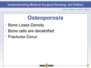 Understanding Medical Surgical Nursing, 3rd Edition
                                     Linda S. Williams / Paula D. Hopper




              Osteoporosis
 Bone Loses Density
 Bone cells are decalcified
 Fractures Occur
 