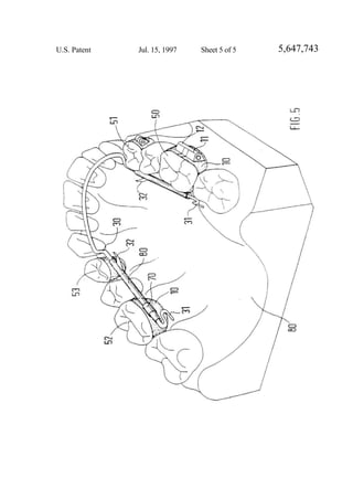 United States Patent