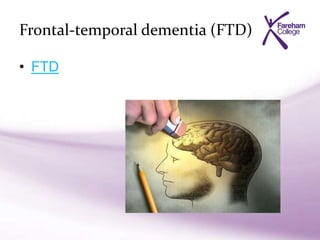 Frontal-temporal dementia (FTD)
• FTD
 