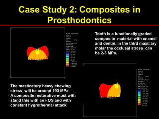 Case Study 2: Composites in
Prosthodontics
Tooth is a functionally graded
composite material with enamel
and dentin. In the third maxillary
molar the occlusal stress can
be 2-3 MPa.
The masticatory heavy chewing
stress will be around 193 MPa.
A composite restorative must with
stand this with an FOS and with
constant hygrothermal attack.
 