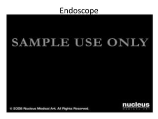 Endoscope