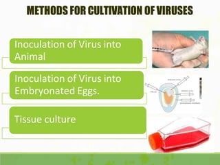 METHODS FOR CULTIVATION OF VIRUSES
Inoculation of Virus into
Animal
Inoculation of Virus into
Embryonated Eggs.
Tissue culture
 