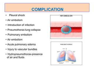 • Pleural shock
• Air embolism
• Introduction of infection
• Pneumothorax-lung collapse
• Pulmonary embolism
• Air embolism
• Acute pulmonary edema
• Injury to vascular bundles
• Hydropneumothorax-presence
of air and fluids
COMPLICATION
 