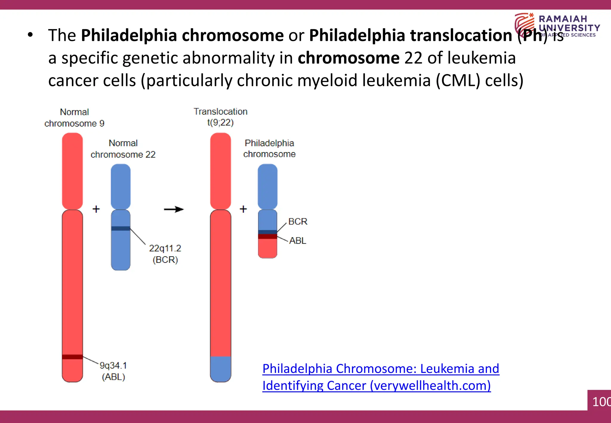 100
• The Philadelphia chromosome or Philadelphia translocation (Ph) is
a specific genetic abnormality in chromosome 22 of leukemia
cancer cells (particularly chronic myeloid leukemia (CML) cells)
Philadelphia Chromosome: Leukemia and
Identifying Cancer (verywellhealth.com)
 