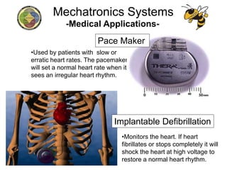 -Medical Applications-
•Used by patients with slow or
erratic heart rates. The pacemaker
will set a normal heart rate when it
sees an irregular heart rhythm.
•Monitors the heart. If heart
fibrillates or stops completely it will
shock the heart at high voltage to
restore a normal heart rhythm.
Mechatronics Systems
Pace Maker
Implantable Defibrillation
 