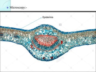 Microscopy:-
Epidermis
 