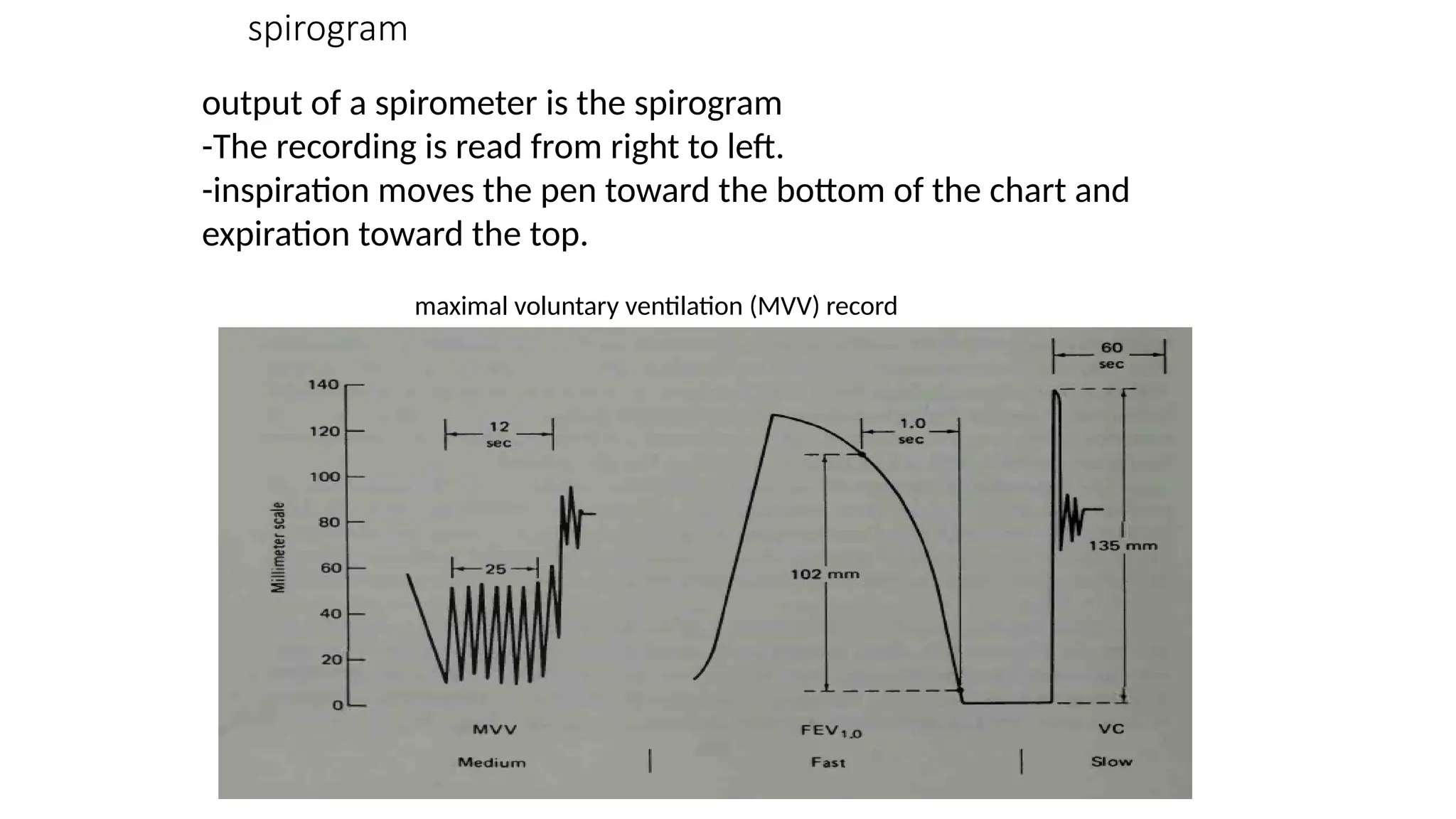 spirogram
output of a spirometer is the spirogram
-The recording is read from right to left.
-inspiration moves the pen toward the bottom of the chart and
expiration toward the top.
maximal voluntary ventilation (MVV) record
 