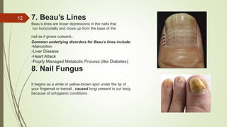 Unit IV Assessment of nail.pptx