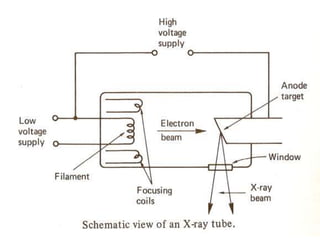 RADIOGRAPHY (RT)