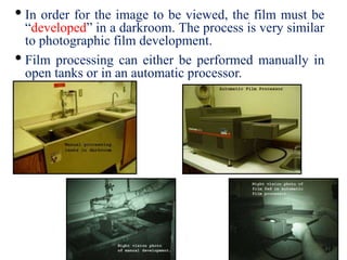 • In order for the image to be viewed, the film must be
“developed” in a darkroom. The process is very similar
to photographic film development.
• Film processing can either be performed manually in
open tanks or in an automatic processor.
 