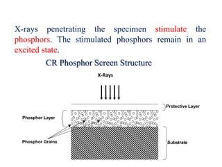 CR Phosphor Screen Structure
X-rays penetrating the specimen stimulate the
phosphors. The stimulated phosphors remain in an
excited state.
X-Rays
Phosphor Layer
Protective Layer
SubstratePhosphor Grains
 