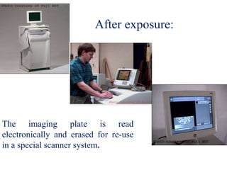 After exposure:
The imaging plate is read
electronically and erased for re-use
in a special scanner system.
 