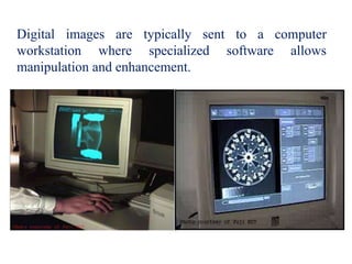 Digital images are typically sent to a computer
workstation where specialized software allows
manipulation and enhancement.
 