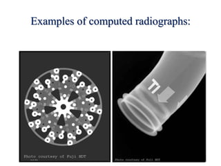 Examples of computed radiographs:
 