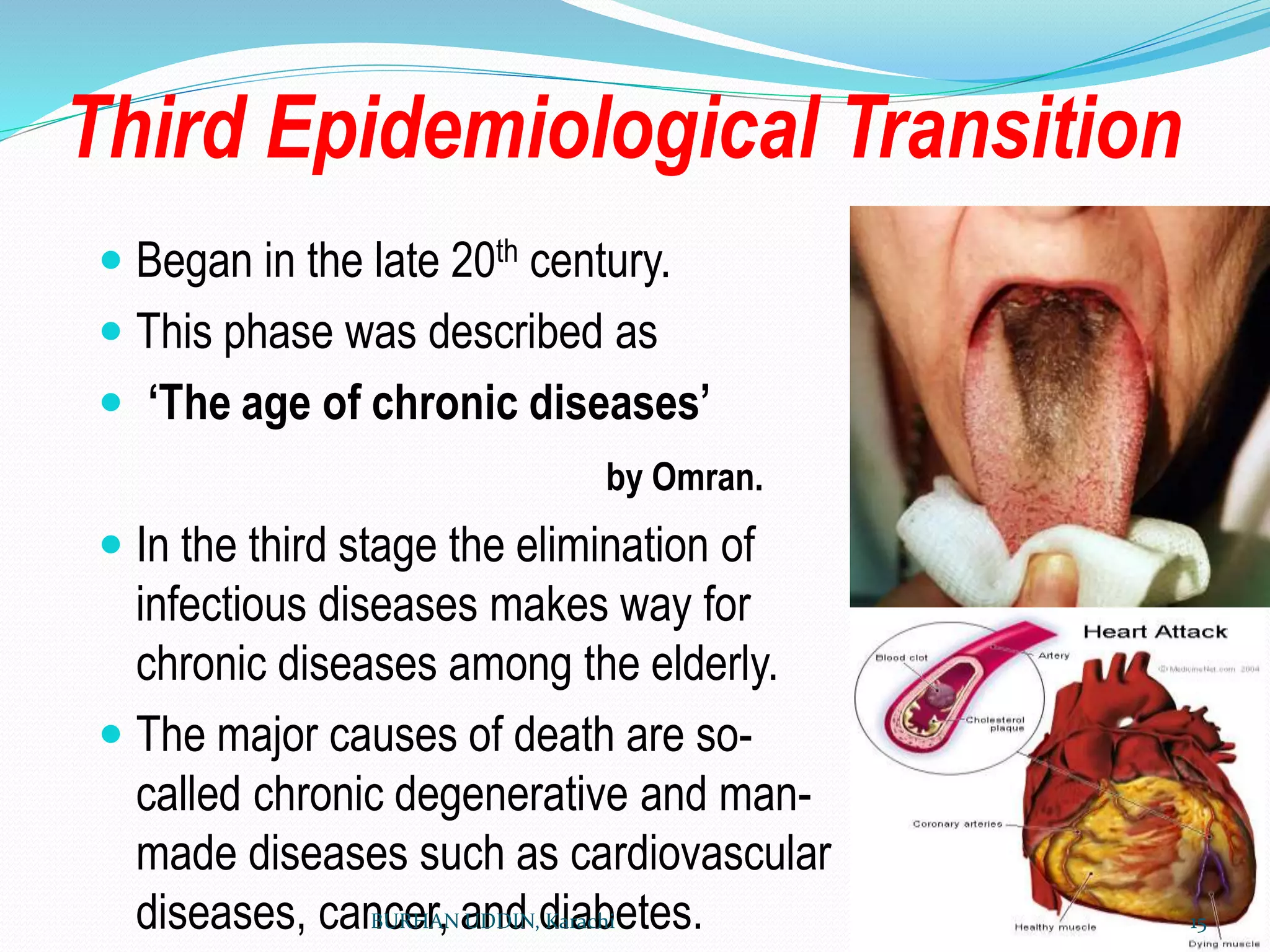Third Epidemiological Transition
 Began in the late 20th century.
 This phase was described as
 ‘The age of chronic diseases’
by Omran.
 In the third stage the elimination of
infectious diseases makes way for
chronic diseases among the elderly.
 The major causes of death are so-
called chronic degenerative and man-
made diseases such as cardiovascular
diseases, cancer, and diabetes.
BURHAN UDDIN, Karachi 15
 