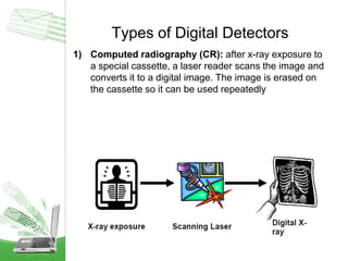 Types of Digital Detectors
1) Computed radiography (CR): after x-ray exposure to
a special cassette, a laser reader scans the image and
converts it to a digital image. The image is erased on
the cassette so it can be used repeatedly
 