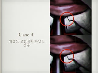 Case 4.
해상도 상한선에 부딛친
경우
 