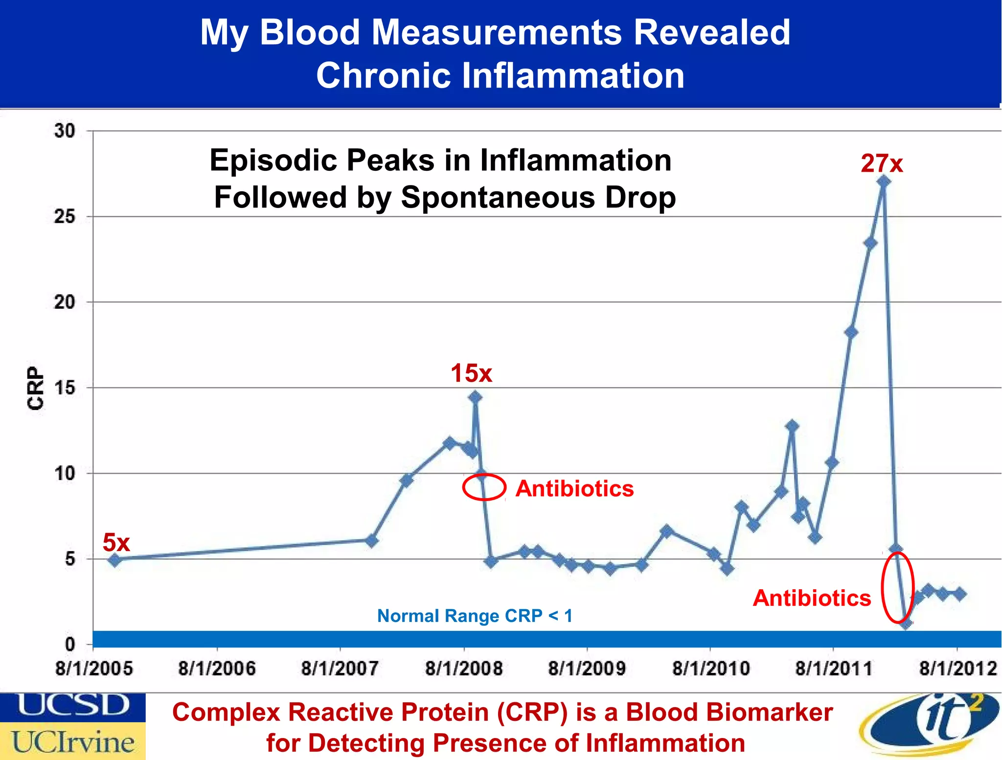 My Blood Measurements Revealed
             Chronic Inflammation

       Episodic Peaks in Inflammation                      27x
       Followed by Spontaneous Drop




                           15x



                                  Antibiotics

5x

                                                 Antibiotics
                    Normal Range CRP < 1




     Complex Reactive Protein (CRP) is a Blood Biomarker
           for Detecting Presence of Inflammation
 
