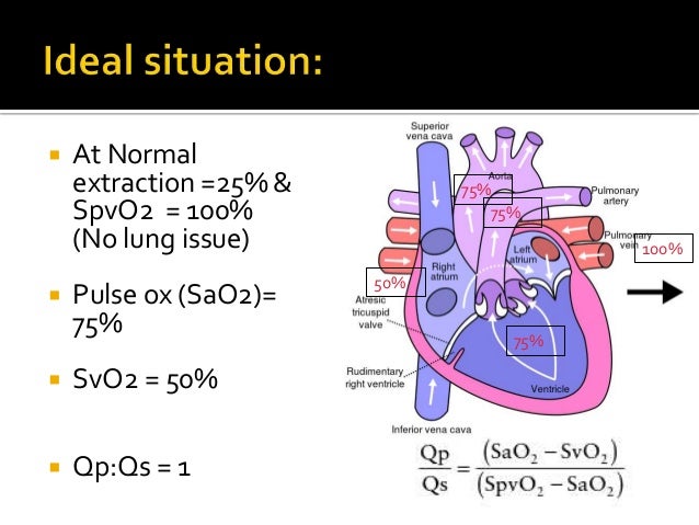 Univentricular circulation