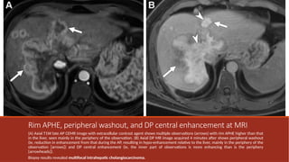 Universal Liver Imaging Lexicon - Imaging Atlas for Research and ...