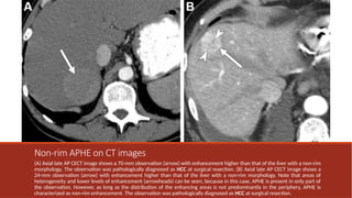 Universal Liver Imaging Lexicon - Imaging Atlas for Research and ...