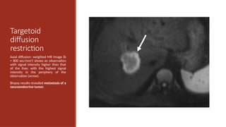 Universal Liver Imaging Lexicon - Imaging Atlas for Research and ...