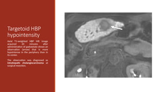 Universal Liver Imaging Lexicon - Imaging Atlas for Research and ...
