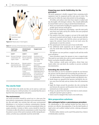 8 ABC of Practical Procedures
The sterile field
The sterile field is the sterile area that can be used as a work area
when carrying out a sterile procedure. It is essential that this area is
kept free from microorganisms and spores.
The environment
Any sterile procedures should be carried out in a clean area, free
from airborne contamination.All surfaces to be used must be clean,
dry, flat and stable. Any activities that will cause environmental
disturbances or an increase in airborne contamination (dusting,
bed-making etc.) should not be carried out immediately before an
aseptic procedure. Curtains or fabric screens should be closed for
10 minutes to allow the airborne contaminates to settle. Ensure that
the patient is aware of the need to maintain sterility during the pro-
cedure, as he/she may accidentally touch the sterile field.
Preparing your sterile field/trolley for the
procedure
All sterile equipment is double wrapped. Packs containing sterile
equipment must be unopened and the seals must be intact. The
pack must be within the expiry date printed on the packaging.
All trolleys and surfaces must have been wiped or washed each
day thoroughly with detergent solution. They should additionally
be cleaned before each use using an alcohol-based disinfectant.
Wash your hands before handling the equipment and don a dis-
1
posable apron and non-sterile gloves.
Touch only the outside layer of packaging – open the outer packs
2
away from your body, and tip the contents onto your proposed
work surface (trolley).
The outside of the inner wrapper is not part of the sterile field
3
and may be touched with the hands. To open the pack, hold the
corners of the wrapper only. Pull the corners out and down to
expose the contents. Ensure that you do not reach across the
opened pack or touch the contents.
The opened pack now becomes part of your sterile field.
4
Any additional sterile equipment can be tipped or dropped
5
onto this sterile field, ensuring that the sterile surfaces are not
touched.
The operator can now perform a surgical scrub and don sterile
gown and gloves.
Some procedures require the operator to wear a surgical mask.
This must be worn before the scrub to avoid contamination of the
hands. Local policy should be adhered to.
When wearing a sterile gown and gloves, always keep your
hands within view and above the waistline to prevent accidental
decontamination.
Extending the sterile field
The sterile field can now be extended to include the area between
the operator and the patient and surrounding the procedure site.
The skin is decontaminated using a bactericidal preparation of
1
2% chlorhexidine in 70% isopropyl alcohol, and allowed to dry.
Sterile drapes are opened by the operator, and held by the cor-
2
ners away from the body and any surfaces that will contaminate
them.
Apply the drapes around the procedure site, also covering the
3
area between the operator and the patient: leave only the decon-
taminated area of skin exposed.
Drapes are placed from the back to the front to avoid contami-
4
nating the operator’s gown or gloves.
Gloves must be changed if they touch a non-sterile area.
5
Skin preparation solutions
Skin antisepsis before a percutaneous procedure
2% chlorhexidine in 70% isopropyl alcohol has been shown to
provide very effective skin preparation. It has the dual benefits of
rapid action and excellent residual activity, reducing subsequent
colonisation.
Povidine iodine solution can be used if the patient has a history
of chlorhexidine sensitivity.
Table 3.1 Summary of the three levels of hand hygiene.
Liquid soap
and water
Alcohol-based
handrub
Surgical scrub
Level 1 Level 2 Level 3
Action Removal of physical
contaminants: dirt,
organic matter
Killing of transient
ﬂora on physically
clean hands
Disinfection and
removal of transient
and resident ﬂora
from hands
When When hands are
physically dirty and
after using the toilet
Between patients
Before applying
gloves for
procedures such
as venepuncture,
urinary
catheterisation,
lumbar puncture,
joint aspiration, etc
Prior to surgical
procedures
Before applying sterile
gloves to carry out a
procedure where an
implantable device is
to be inserted such
as central venous,
epidural and cardiac
catheters, and
pacemakers
Figure 3.3 Missed areas in hand hygiene.
Back
Front
Least missed
Sometimes missed
Most missed
 