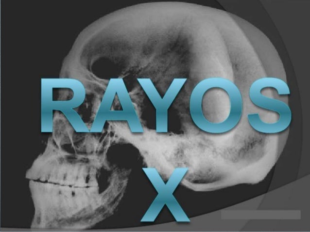 Historia de los rayos x