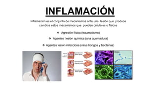 INFLAMACIÓN
Inflamación es el conjunto de mecanismos ante una lesión que produce
cambios estos mecanismos que pueden celulares o físicos
 Agresión física (traumatismo)
 Agentes lesión química (una quemadura)
 Agentes lesión infecciosa (virus hongos y bacterias)
 