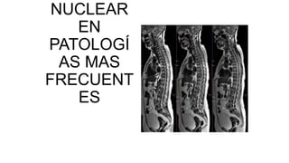 NUCLEAR
EN
PATOLOGÍ
AS MAS
FRECUENT
ES
 