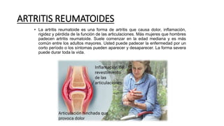 ARTRITIS REUMATOIDES
• La artritis reumatoide es una forma de artritis que causa dolor, inflamación,
rigidez y pérdida de la función de las articulaciones. Más mujeres que hombres
padecen artritis reumatoide. Suele comenzar en la edad mediana y es más
común entre los adultos mayores. Usted puede padecer la enfermedad por un
corto período o los síntomas pueden aparecer y desaparecer. La forma severa
puede durar toda la vida.
 