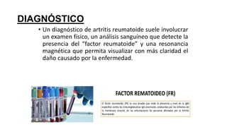 DIAGNÓSTICO
• Un diagnóstico de artritis reumatoide suele involucrar
un examen físico, un análisis sanguíneo que detecte la
presencia del “factor reumatoide” y una resonancia
magnética que permita visualizar con más claridad el
daño causado por la enfermedad.
 