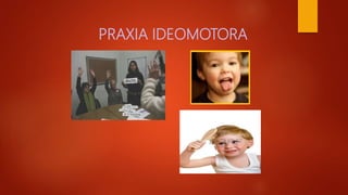 PRAXIA IDEOMOTORA
 