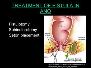 Rectum and anus diseases | PPT