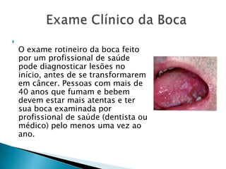 O exame rotineiro da boca feito por um profissional de saúde pode diagnosticar lesões no início, antes de se transformarem em câncer. Pessoas com mais de 40 anos que fumam e bebem devem estar mais atentas e ter sua boca examinada por profissional de saúde (dentista ou médico) pelo menos uma vez ao ano.        Exame Clínico da Boca