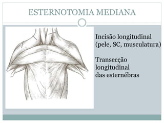 ESTERNOTOMIA MEDIANA
Incisão longitudinal
(pele, SC, musculatura)
Transecção
longitudinal
das esternébras