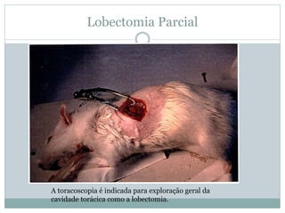 Lobectomia Parcial
A toracoscopia é indicada para exploração geral da
cavidade torácica como a lobectomia.