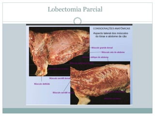 Lobectomia Parcial