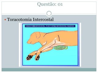 Questão: 01
Toracotomia Intercostal