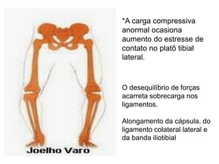 *A carga compressiva
anormal ocasiona
aumento do estresse de
contato no platô tibial
lateral.

O desequilíbrio de forças
acarreta sobrecarga nos
ligamentos.
Alongamento da cápsula, do
ligamento colateral lateral e
da banda iliotibial

 