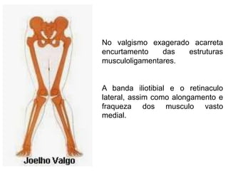 No valgismo exagerado acarreta
encurtamento
das
estruturas
musculoligamentares.

A banda iliotibial e o retinaculo
lateral, assim como alongamento e
fraqueza dos musculo vasto
medial.

 