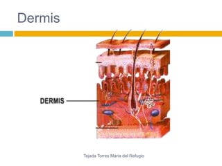 Dermis 
Tejada Torres Maria del Refugio 
 