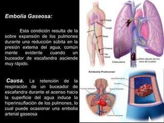 Embolia Gaseosa:
Esta condición resulta de la
sobre expansión de los pulmones
durante una reducción súbita en la
presión externa del agua, común
mente evidente cuando un
buceador de escafandra asciende
muy rápido.
Causa. La retención de la
respiración de un buceador de
escafandra durante el acenso hacia
la superficie del agua induce la
hiperinsuflación de los pulmones, lo
cual puede ocasionar una embolia
arterial gaseosa
 