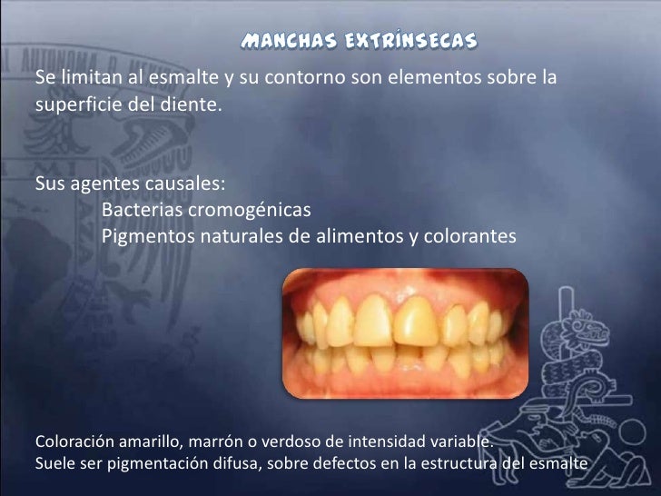 ESTETICA DENTAL,,POR JOSUE BENJAMIN