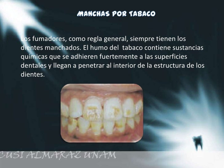 La crema para el blanqueamiento de la cutis y la eliminación de las manchas de pigmento las revocaci