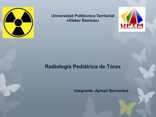 Universidad Politécnica Territorial
«Kleber Ramírez»
Radiología Pediátrica de Tórax
Integrante: Aymari Barrientos
 