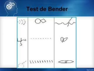 Test de Bender
 