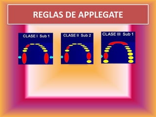 REGLAS DE APPLEGATE